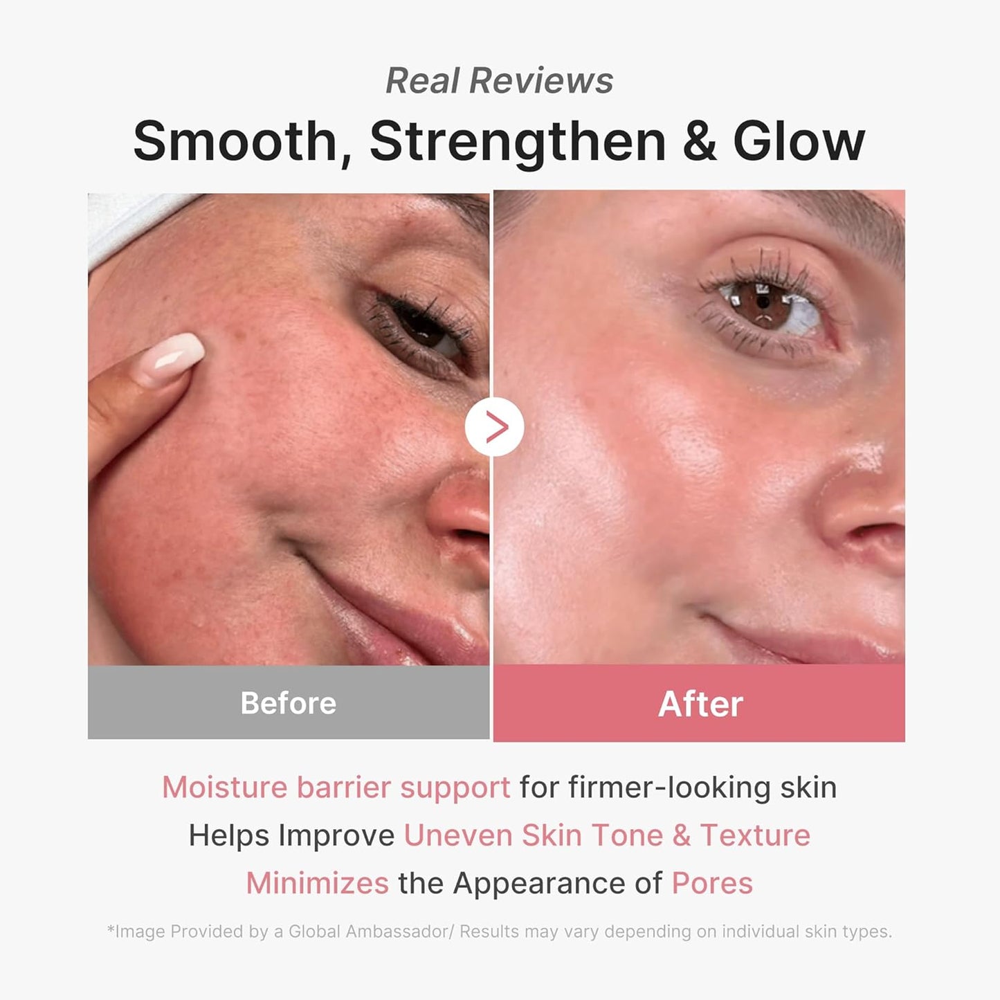 Before and after comparison of skin texture with text highlighting product benefits.