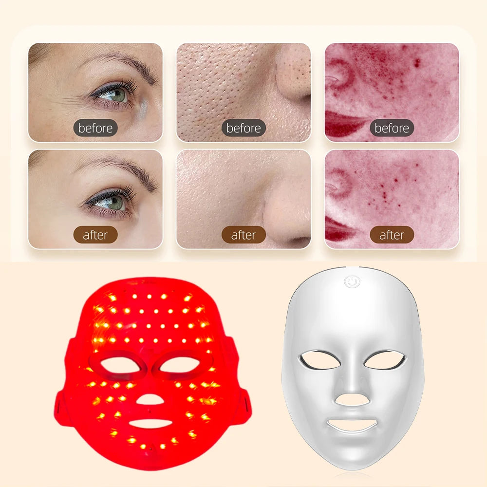 Before and after effects of a LED face mask on skin with two masks displayed below.